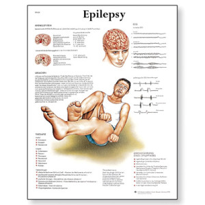 VR1626L_01_Epilepsy-Chart